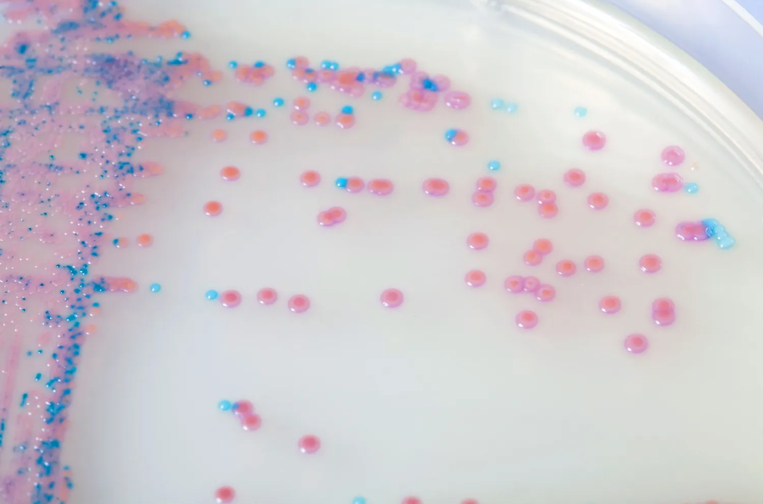 CHROMagar Staph Aureus. Medio de cultivo cromogénico para la detección y recuento de S. aureus.