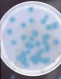 CHROMagar Pseudomonas. Medio cromogénico deshidratado para el aislamiento y detección de Pseudomonas spp