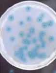 CHROMagar Pseudomonas. Medio cromogénico deshidratado para el aislamiento y detección de Pseudomonas spp