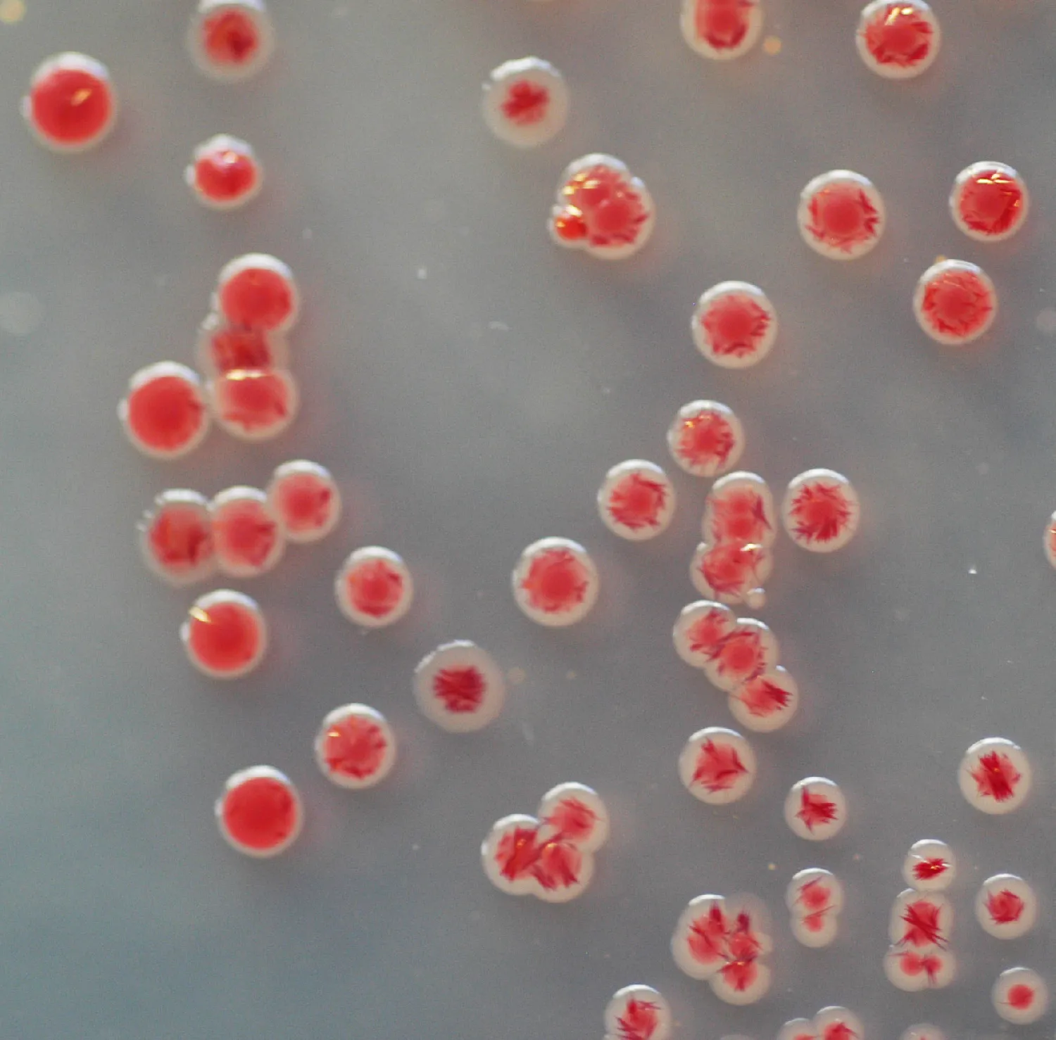 CHROMagar Acinetobacter. Medio cromogénico deshidratado para la detección de Acinetobacter spp. 