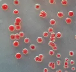 CHROMagar Acinetobacter. Medio cromogénico deshidratado para la detección de Acinetobacter spp. 