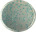 CHROMagar E. coli. Medio de cultivo cromogénico para la detección y recuento de E.coli.