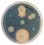 CHROMagar™ Muller Hinton Orientation Agar