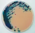 Rambach Agar Salmonella