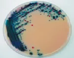 Rambach Agar Salmonella