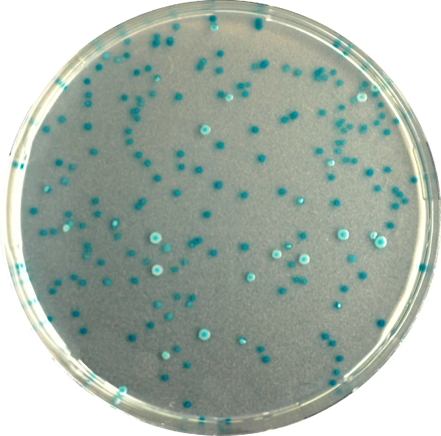 CHROMagar E. coli. Medio de cultivo cromogénico para la detección y recuento de E.coli.