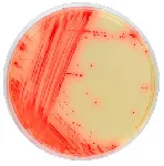 CHROMagar™ Mycoplasma