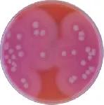 Bacillus cereus, Agar Base