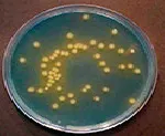 CLED, Agar