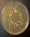 Cloranfenicol Glucosado (CGA), Agar