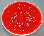 Sangre (Columbia), Agar Base