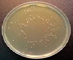 Ensayo de carga microbiana, Agar para el