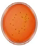 MacConkey Sorbitol (Modificado), Agar