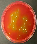 Manitol Hipersalino (Eur. Pharm.), Agar de