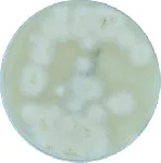 Sabouraud Dextrosado, Agar