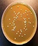 Sabouraud Oxitetraciclina (OGYEA), Agar de