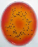 Salmonella Shigella (SS), Agar