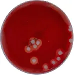 Sangre Nº2, Agar Base