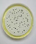 Clostridium perfringens, Agar selectivo