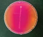 Urea, Agar Base