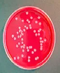 Verde Brillante (BGA), Agar