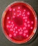 Rojo Bilis Violeta Lactosa (RBVL), Agar