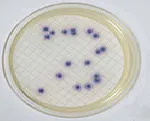 Colinstant Agar Cromogénico Microinstant®