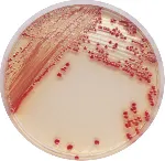 CHROMagar™ Acinetobacter