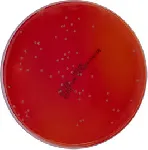 Burkholderia cepacia (Base), Agar Selectivo para